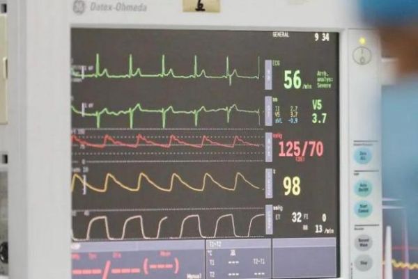 什么運動對心臟最健康？