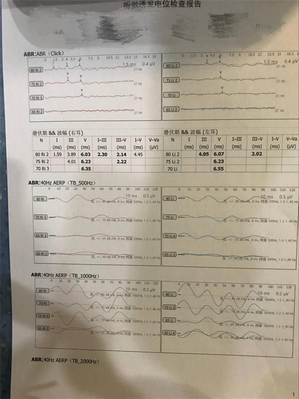 职业健康检查｜一文教你了解听力测试那些事儿