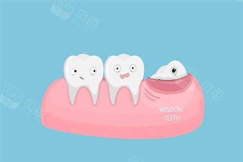 牙齿模型卡通图