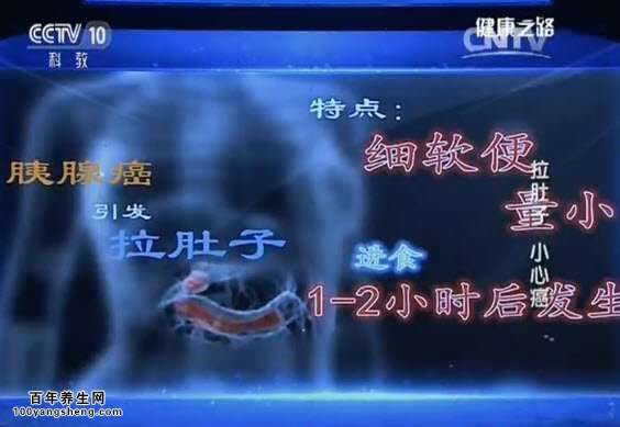 胰腺癌引發(fā)的腹瀉特點(diǎn)