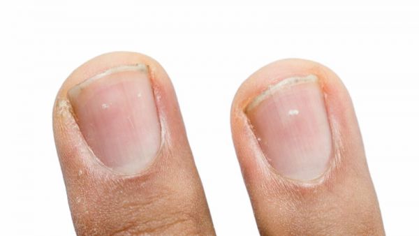 身體有沒有生病，或許看指甲能夠知曉，你知道怎么看嗎