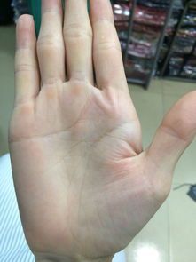 得癌症的都有健康线吗