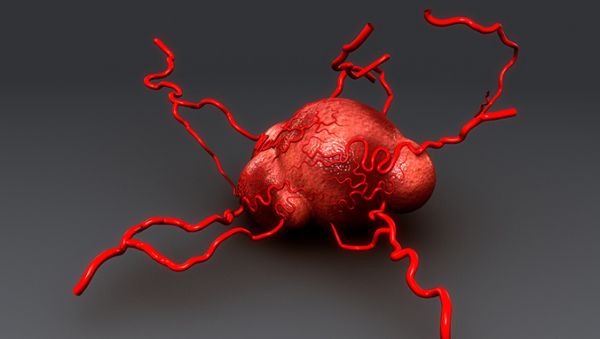 肺癌晚期用恩度效果好吗