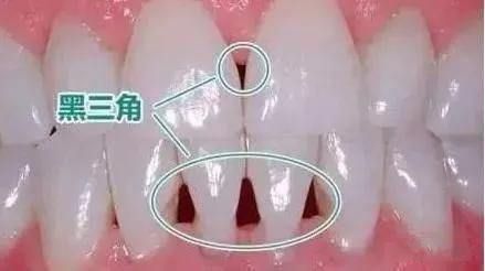 96861590739343350
