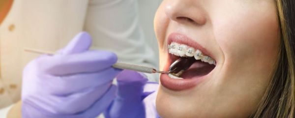 蛀牙如何让它停止腐蚀 如何预防蛀牙 如何防治继续蛀牙