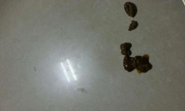 狗狗拉粑粑，如何判斷正常與不正常（寵物的健康需我們關(guān)注）