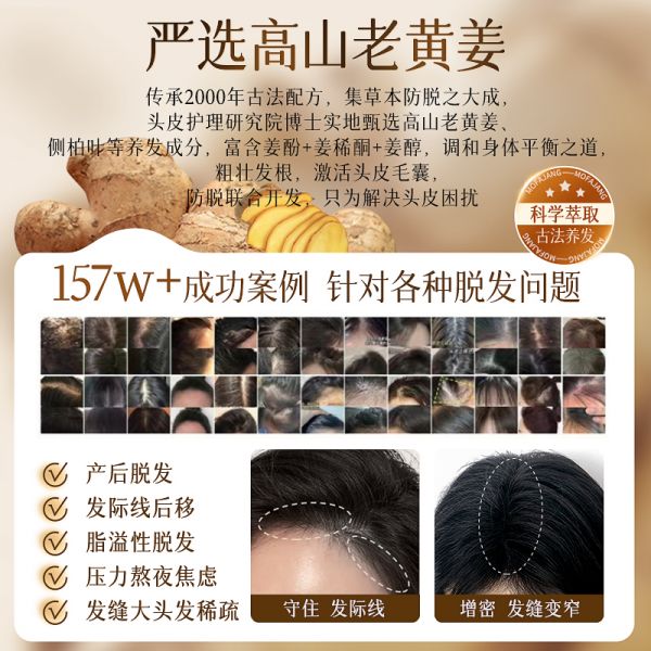 【若安好洗发水12】怎么调节头皮水油平衡：三个魔发匠生姜洗发水防脱固发控油蓬松去屑正品牌露膏59734