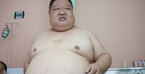 肥胖兒童,兒童肥胖,兒童減肥