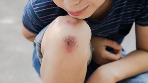 自己在家怎么练腿