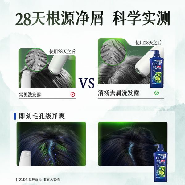 【若安好洗发水59】头发漂完发黄怎么变白：清扬洗发水露液男士控油蓬松去屑止痒洗头膏头痒正品品牌旗舰51924