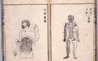 知道嗎？這些醫(yī)學(xué)詞語也是日本人創(chuàng)生的