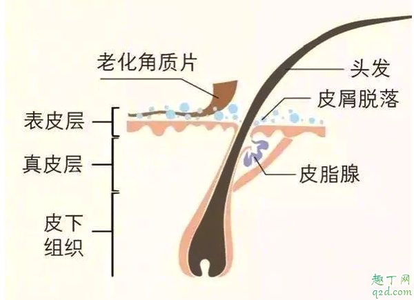 健康的頭皮是什么狀態(tài) 怎樣改善頭皮狀態(tài)2