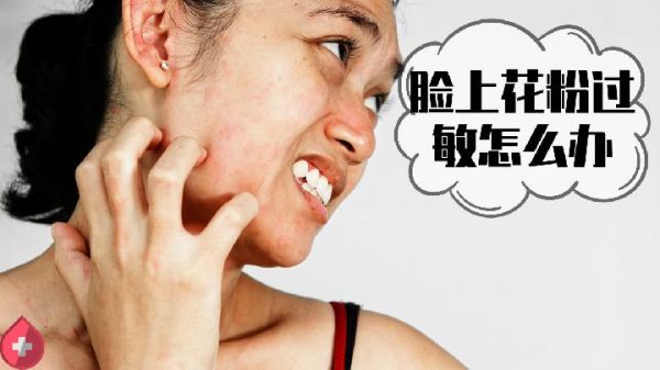 臉部經(jīng)常出油說明不健康 油性肌膚護(hù)理有妙招