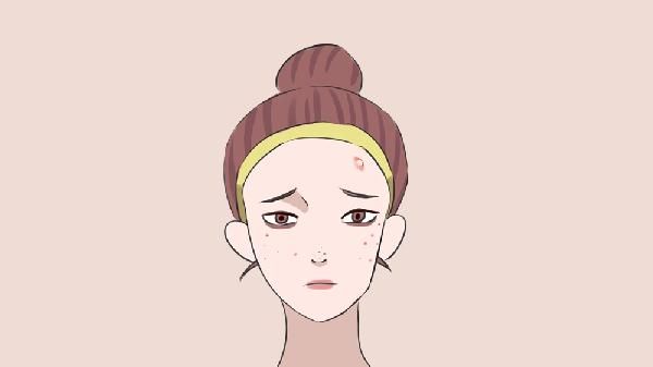 挤痘后怎么不留痘印