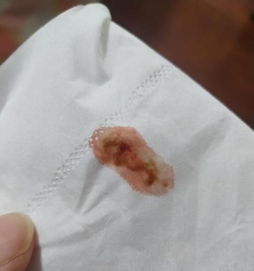 如何判斷貓咪的糞便是否健康（掌握貓咪糞便的顏色、質(zhì)地和氣味）