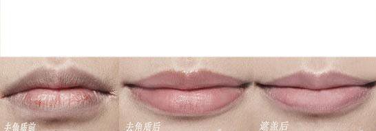 冬季唇部护理方案 让你拥有健康好唇色