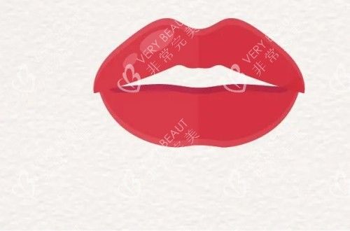 上下唇都比較厚的唇形卡通示意圖