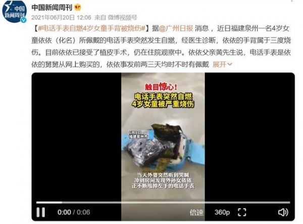 紅疹？燙傷？ 你的智能手表真的戴對了嗎？ 