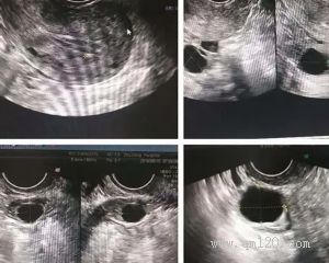 女性飲食需要注意哪幾個方面？