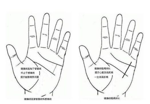 從手相健康線來看你的身體狀況。