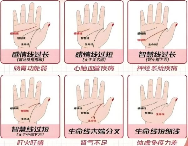 掌紋看你的健康狀況