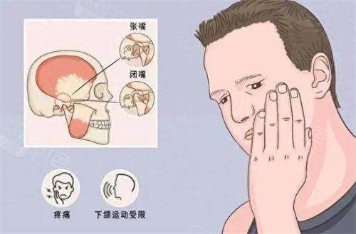 咬合不對的狀態(tài)