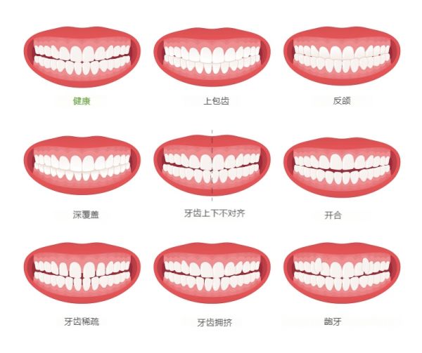 正常牙齒和不正常牙齒咬合對比圖.jpg