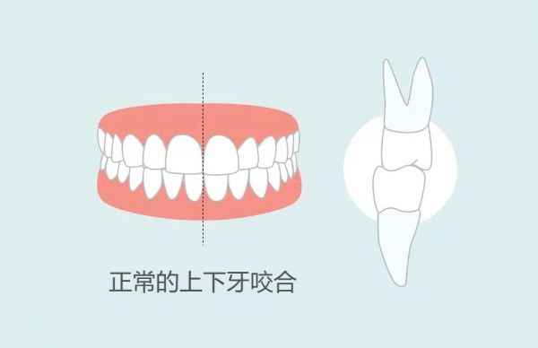 牙齒上下牙正常咬合圖