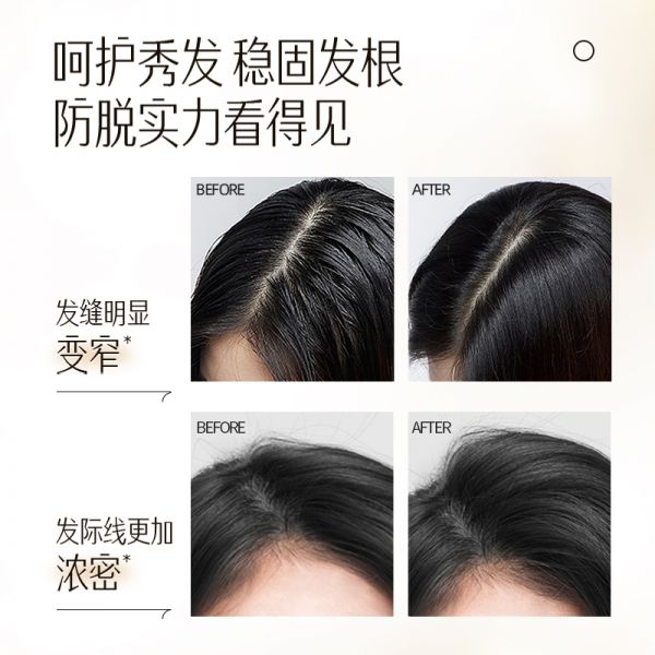 【若安好洗發(fā)水24】如何挑選洗發(fā)水的正確方法:【楊紫推薦】云南白藥養(yǎng)元青新品控油蓬松防脫發(fā)女男洗發(fā)水洗發(fā)露61122