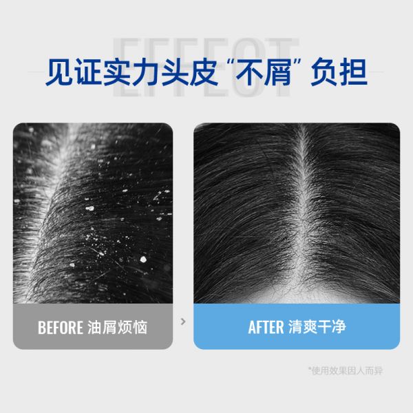 【若安好洗发水06】洗发水什么样的最好最健康：二硫化硒去屑红没药醇洗发水止痒控油舒缓蓬松60331