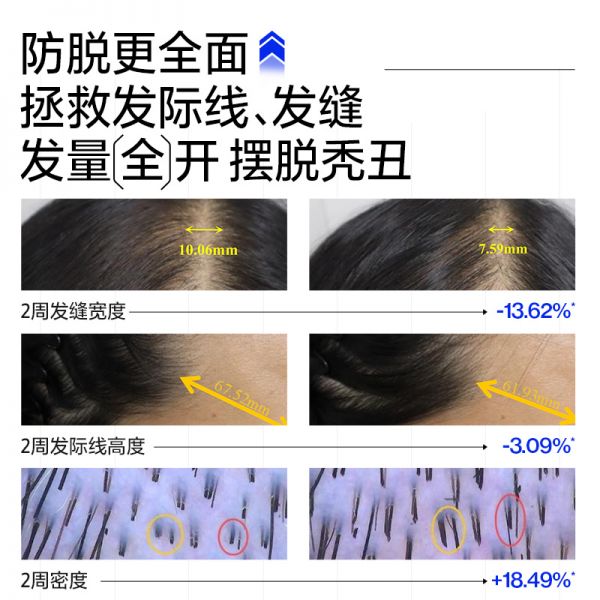 【若安好洗發(fā)水26】頭發(fā)洗發(fā)水怎么選:EHD防脫洗發(fā)水控油蓬松去屑固發(fā)防斷何首烏側(cè)柏葉男女洗頭膏露60513