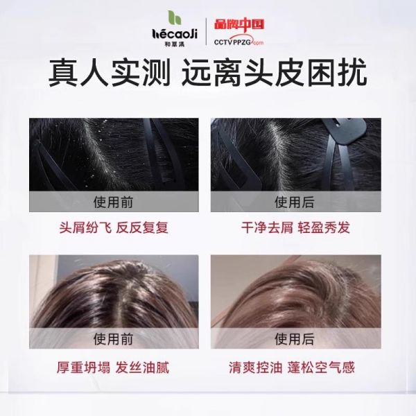 【久奇詩洗發(fā)水23】用什么洗發(fā)水最健康女生：和草集洗發(fā)水去屑控油毛囊清潔去頭皮屑專用二硫化硒洗頭發(fā)膏23083