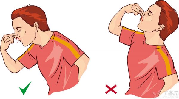 【题图】鼻出血900X500.jpg