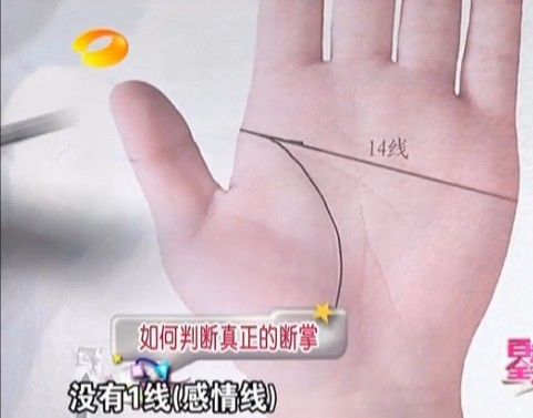 通過掌紋了解身體健康 （王晨霞老師）  自己整理《百科全說》