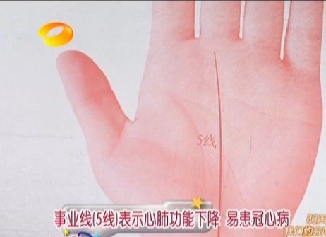 通過掌紋了解身體健康 （王晨霞老師）  自己整理《百科全說》