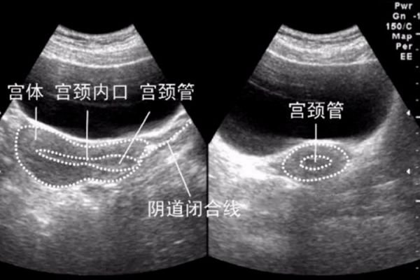 健康超聲檢查圖