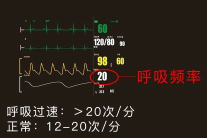 呼吸頻率圖