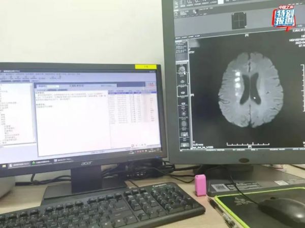 病歷單模板自己填寫可以嗎怎么寫