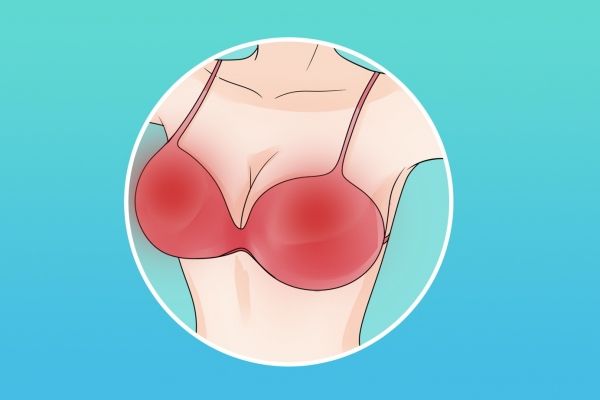 如何正確穿戴胸罩