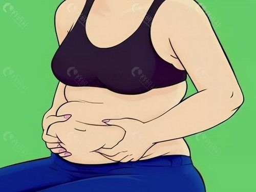 社?？梢詧?bào)銷吸脂費(fèi)用嗎？