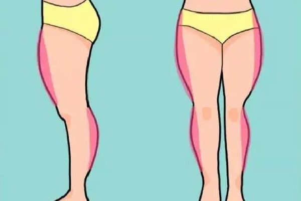 吸脂可以报医保吗 吸脂去三甲医院还是美容医院