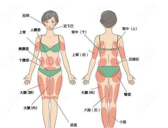 全身吸脂有哪些部位