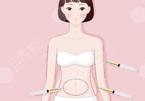 左萬昌醫(yī)生吸脂怎么樣？