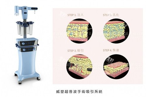 威塑手術(shù)機(jī)器與手術(shù)方式演示圖