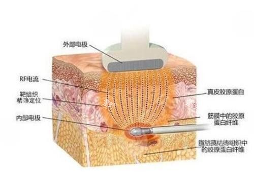 黃金微雕的作用
