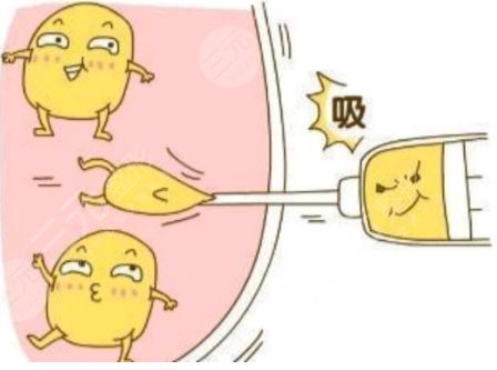 抽脂手術(shù)大概花多少錢?