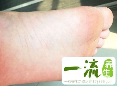 按摩減肥 按摩四個穴位能消脂減肥