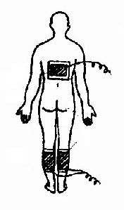 足關(guān)節(jié)和手指關(guān)節(jié)電水浴法