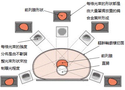 電療