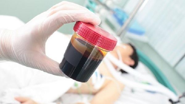 黑木耳补血瘦身食谱 强效来袭一周瘦7斤